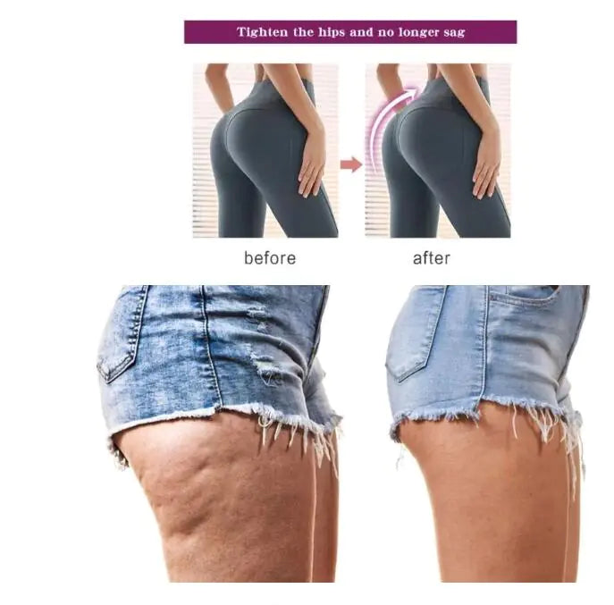 RtopR Body Cream for Buttocks Enhancement
